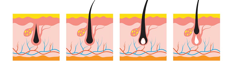 Hårets livscykel är uppdelad i 3 olika faser: tillväxtfasen, övergångsfasen och avstötningsfasen.
