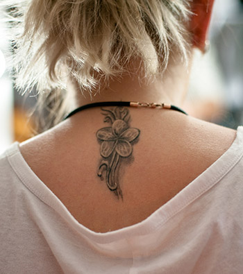 Ta bort tatuering med laser Ta bort tatuering med laser